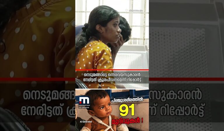 ആ പിഞ്ചുശരീരത്തില്‍ 91 മുറിവുകൾ, നട്ടെല്ലിൽ 7 പൊട്ടൽ; ഒന്നരവയസുകാരൻ നേരിട്ടത് ക്രൂരപീഡനം